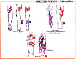 Trigger Point Referral Patterns Balance In Motion Bodywork