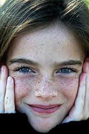 Pin By Gamze Kurt On Freckles Freckles Girl Beautiful Freckles Freckles