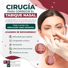 Siempre sientes la nariz tapada? 😵‍💫 Podría ser un tabique desviado, y  sí, ¡tiene solución! La cirugía para corregirlo puede ayudarte a respirar  mejor, dormir sin ronquidos y decirle adiós a la