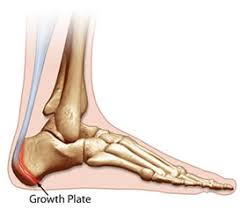 Have a doctor evaluate the problem when those symptoms are. Pay Attention To Your Child S Heel Pain Boulder Medical Center