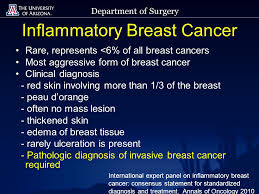 Inflammatory breast cancer symptoms usually start quickly. Department Of Surgery Inflammatory Breast Cancer Julie Lang Md Assistant Professor Of Surgery Director Of Breast Surgical Oncology University Of Arizona Ppt Download