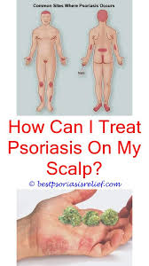 Diet Chart For Psoriasis Patients Psoriasis Cure
