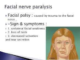 .understanding of the classification of nerve injuries was laid down by seddon, who was the nuffield professor of orthopaedics, after studying some 460 nerve cases in oxford. Nerve Injuries Department Of Oral And Maxillofacial Surgery