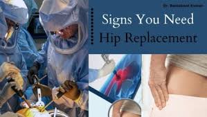 Regular groin and frontal thigh pain pain that limits activity pain that wakes you up at night Blog Best Orthopedic Doctor Patna Arthroscopy Specialist