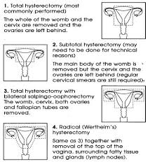 We understand that having an operation can be a very stressful experience. Hysterectomy Milton Keynes University Hospital