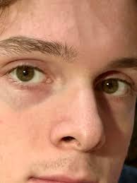 What color are the eyes in the photo?