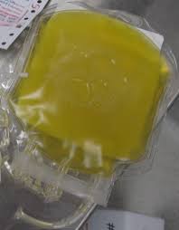Image result for Plasma Transfusion
