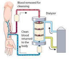 Understand Simply How The Dialysis Machine Works Dialysis Nurse Dialysis Machine Dialysis Clinic