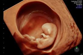 If it has implanted outside your uterus, it's called an ectopic pregnancy, which is a medical emergency. Dating Scans Ultrasound Services