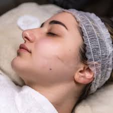 THE BEST 10 LASER HAIR REMOVAL near GUILDFORD, SURREY, BC