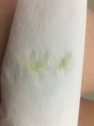 14 Weeks Is This My Mucus Plug December 2017 Babycenter Australia