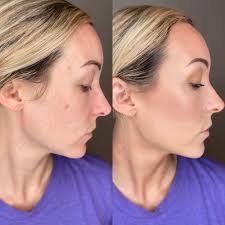 matching tats after the montreal grey day🤩