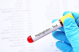 Image result for Haptoglobin