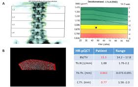 Hence psc is the organization that conducts pcs examinations. Uke I Medizinische Klinik Und Poliklinik Psc Kfo306 Primar Sklerosierende Cholangitis Uke Schramm Dfg