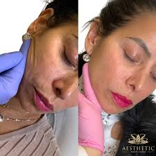 Aesthetic beauty lounge has 4.5 stars. Premier Aesthetic Center Aesthetic Beauty Lounge Highland Park Il