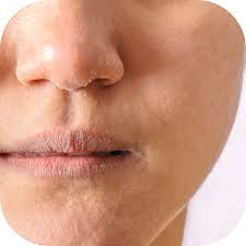 Sự khác biệt giữa da khô và da thiếu nước