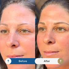 Did You Know: Microblading this month means NO pencil smudging at the  🤿🏖️🌴 when the weather warms up & you're spending your days swimming,  sweating & sunscreening?? ☀️ Want to learn more 🙋‍♀️ drop a ...