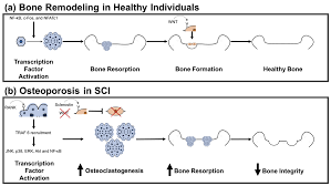 What does a backbone distribution system typically provide? Ijms Free Full Text The Pathophysiology Of Osteoporosis After Spinal Cord Injury Html