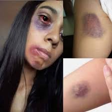 🛑Young woman dies at the hands of her... See more