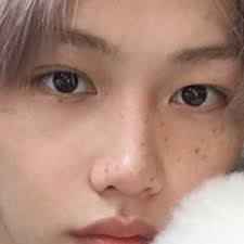 Stray Kids Felix S Freckles Appreciation Post Felix Stray Kids Freckles Felix