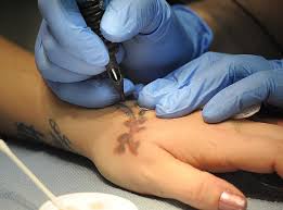 We are the only clinic in san antonio to use the latest generation astanza trinity 2.0 tattoo removal lasers, which allow us to treat all ink colors and all skin colors. The Agony Of Tattoo Removal