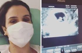 Kyra Gracie Mostra Momento Do Primeiro Ultrassom De Seu Terceiro Filho Presente De Deus Vogue Celebridade