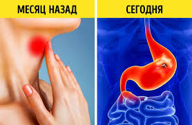 8 Signalov Organizma Kotorye Mogut Preduprezhdat O Yazve Zheludka