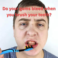 If you want your teeth straightened, we do braces!!#braces #dentist  #fastbraces #orthodontics