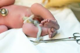Cord blood is a hot commodity. Did You Know Donating Umbilical Cord Blood Could Save A Child S Life Uthealth News Uthealth