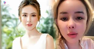 Dàn hot girl gần như "thay mặt” vì dao kéo: Bạn thân Huyền Baby suýt hoại  tử cằm, Ngân 98 mặt biến dạng