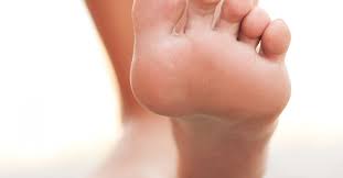 Image result for Clubbing nails feet