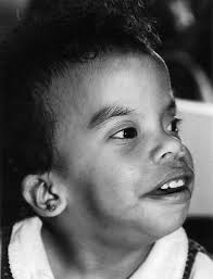 Hand it to the skin in Costello syndrome