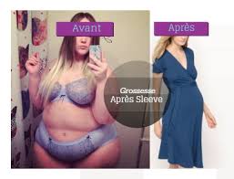 RÃ©sultat de recherche d'images pour "photo grossesse et sleeve"