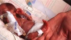 premature bebekleri bekleyen sorunlar saglik haberleri ntv