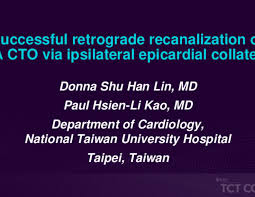 International scientific vocabulary, from latin ipse self, himself + later. Tct 571 Successful Retrograde Recanalization Of Rca Cto Via Ipsilateral Epicardial Collaterals Tctmd Com
