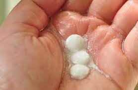 Prid drawing salve for splinters & more pesky splinters, thorns or ingrown hairs? 10 Brilliant Home Remedies For Ingrown Hair Hairy Fairy