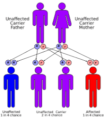 Carnitine Palmitoyltransferase Ii Deficiency Wikipedia