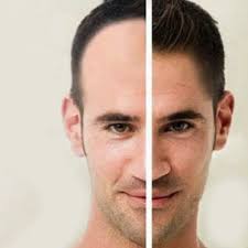 Masturbation does not cause hair loss. Can Masturbation Cause Hair Loss Myths Facts Ahs India