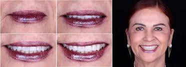 Dr. Hamed Jiménez Castellanos Dentista