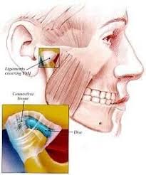 Pin On Neuromuscular Dentistry San Diego