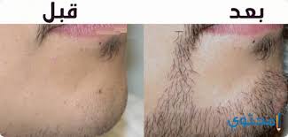 سائق إقراض المال التزام افضل طريقة لانبات شعر اللحية scottygmaster com