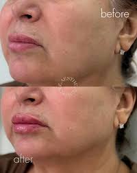 Medicina estética con enfoque regenerativo. Preparando tratamientos que  regeneran desde adentro. Pronto, una nueva experiencia en estética.”  #MedicinaRegenerativa #Antienvejecimiento #cuidadointegral