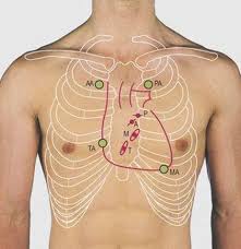 Maybe you would like to learn more about one of these? Thorax Surface Anatomy 4 Edition