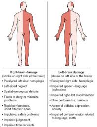 cerebrovascular accident cva right vs left damage