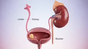 Image result for Urelytrum