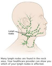 The lymph nodes in the neck have historically been divided into at least six anatomic neck lymph node levels for the purpose of head and neck cancer staging and therapy planning. Excisional Biopsy Neck Lymph Node Articles Mount Nittany Health System