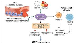 Image result for Colorectal Cancer