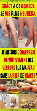 Grace A Ce Remede Je Vis Plus Heureux Je Me Suis Debarrasse Definitivement Des Verrues Sur Ma Peau Sans Laisser De Traces Vegetables