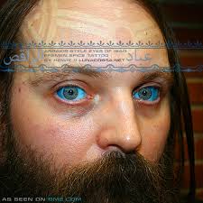 Real Life Horror: Eyeball Tattooing