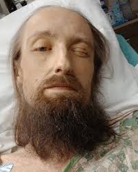 Fundraiser by Haley Elliston : Aid for Josh: Severe Health Battle